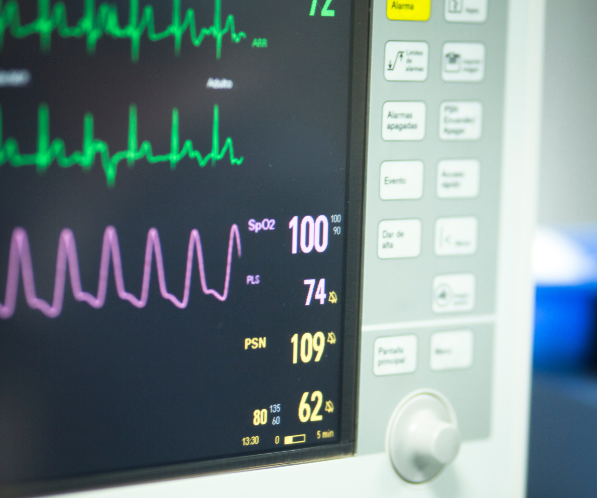 Supraventricular Tachycardia