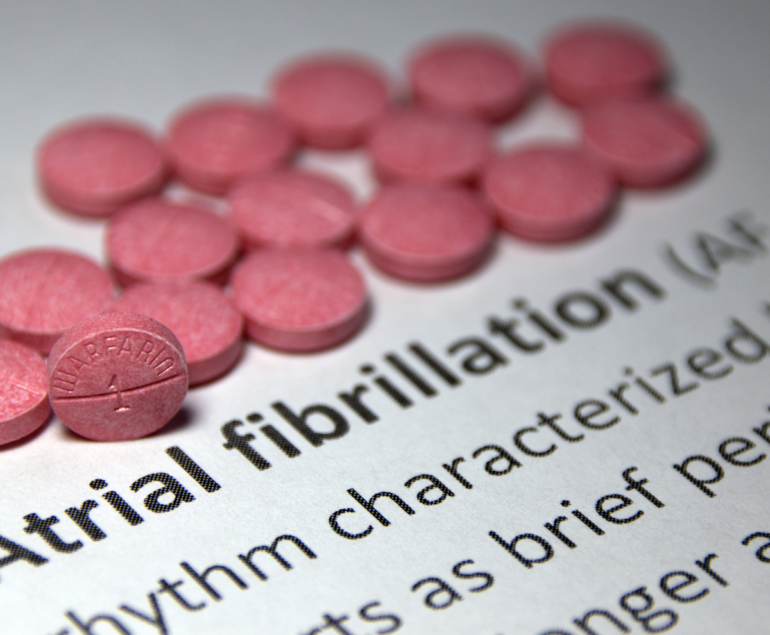 Atrial fibrillation